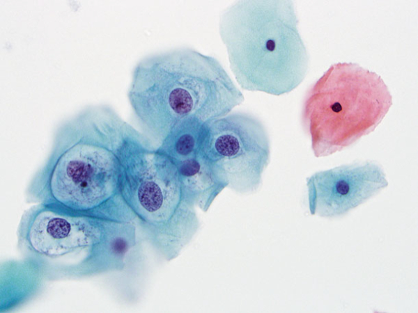 Окраска по Папаниколау Принцип работы всех этих устройств основан на последовательном использовании различных растворов для окрашивания, фиксации и промывки препаратов. Современные аппараты оснащены программным управлением, что позволяет создавать индивидуальные протоколы обработки, минимизировать человеческий фактор и снизить расход реагентов.