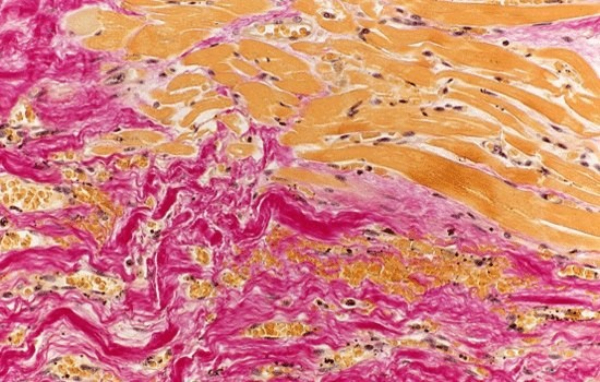 Окраска по Ван-Гизону Принцип работы всех этих устройств основан на последовательном использовании различных растворов для окрашивания, фиксации и промывки препаратов. Современные аппараты оснащены программным управлением, что позволяет создавать индивидуальные протоколы обработки, минимизировать человеческий фактор и снизить расход реагентов.