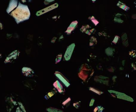 Рис. 4. Фотография кристаллов циркона в проходящем свете с анализатором (поляризационная микроскопия). Фотография кристаллов циркона в проходящем свете с анализатором (поляризационная микроскопия).